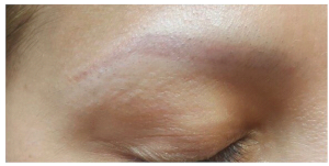 microblading-1.png